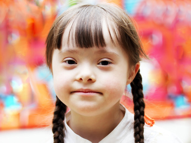 Welt-Down-Syndrom-Tag: Jede zweite Schwangere lässt einen Trisomie-Bluttest machen